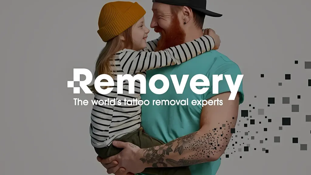 Removery Tattoo Removal & Fading — Tattoo removal service in Buffalo